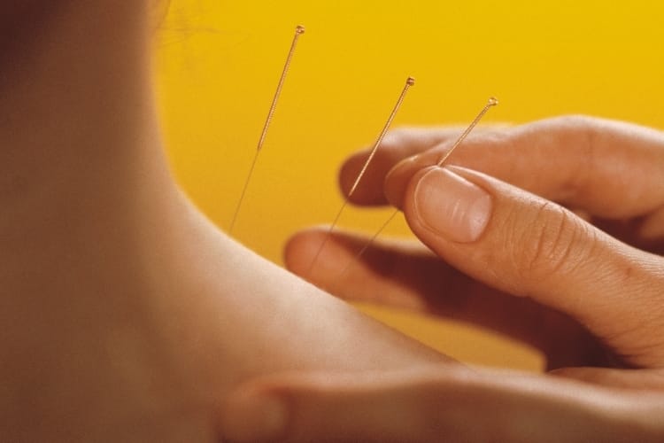  Santé : l’acupuncture à Dubai et la médecine « régénératrice » !